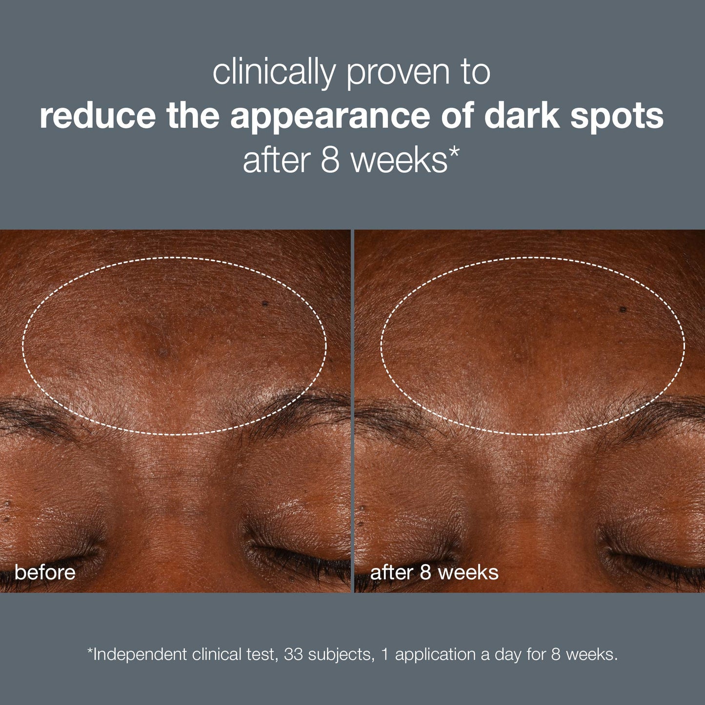 Dynamic Skin Recovery SPF50