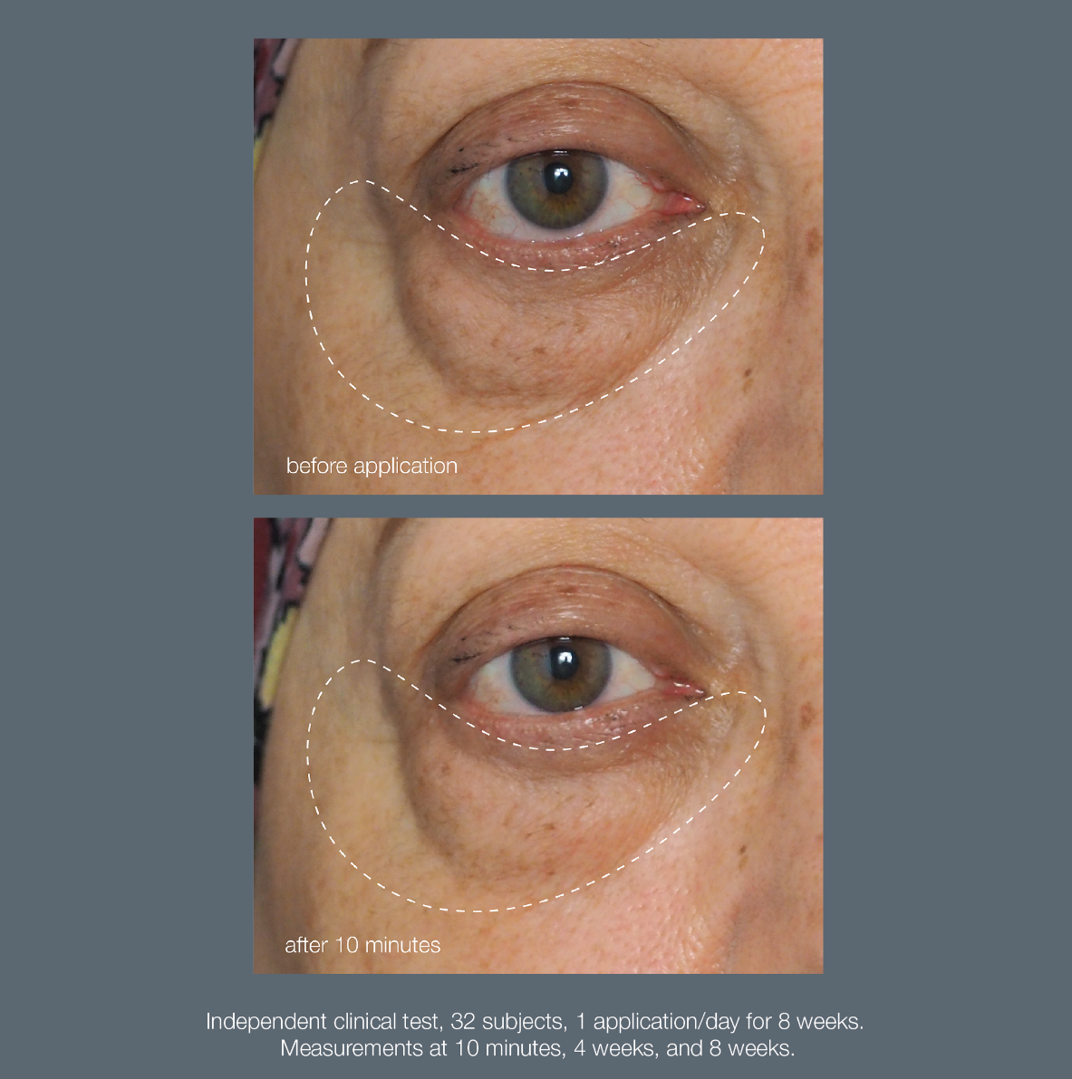 Awaken Peptide Eye Gel