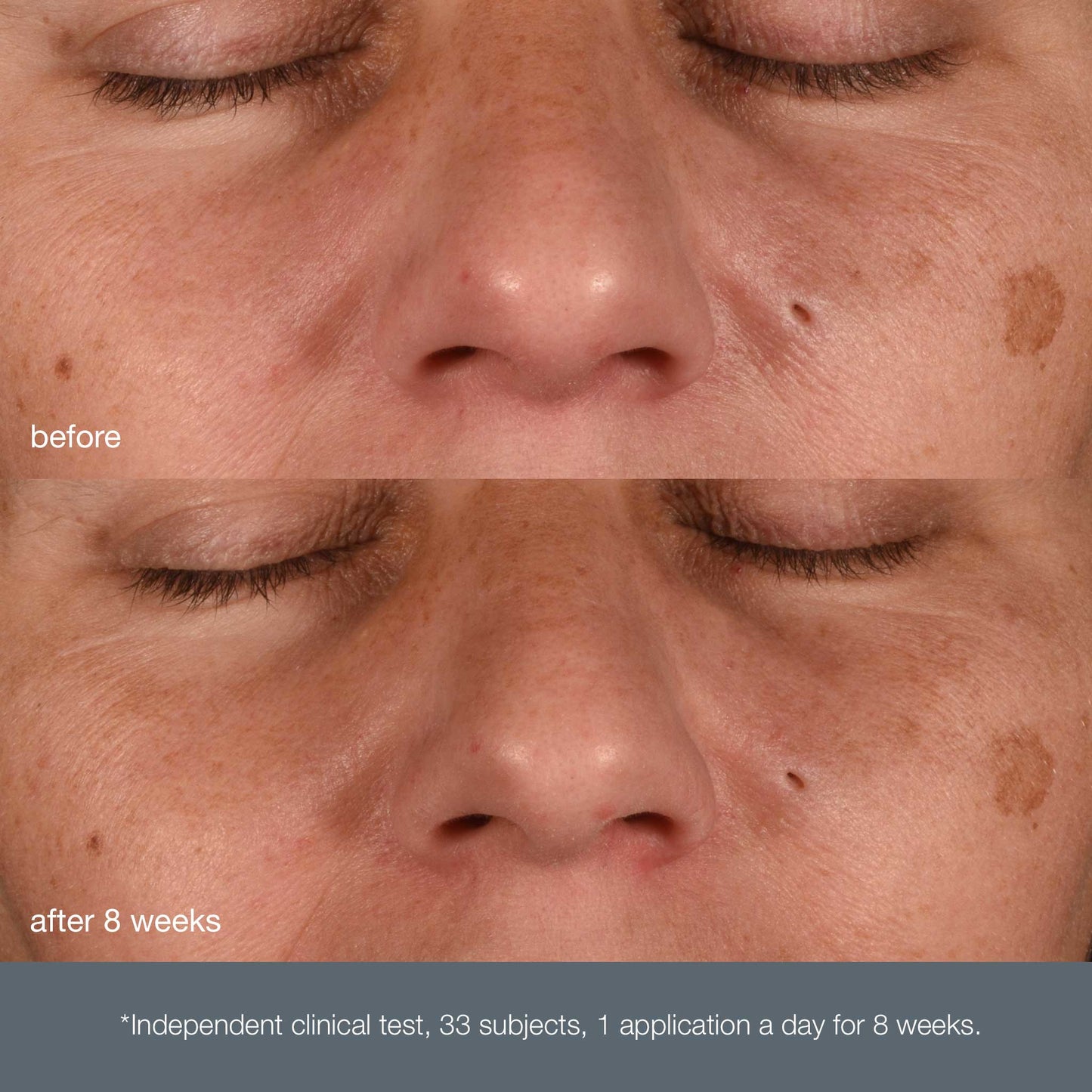Dynamic Skin Recovery SPF50