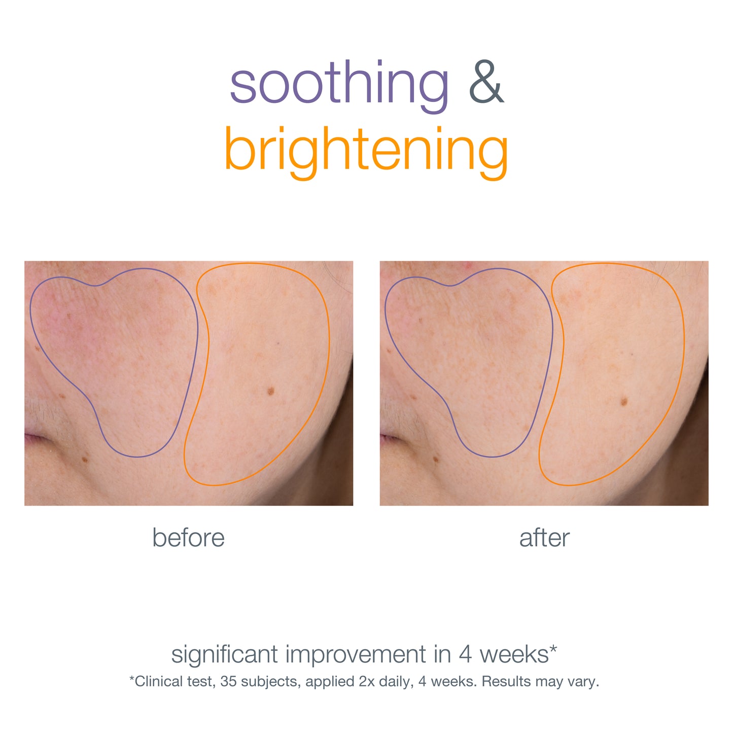 Smart Response Serum