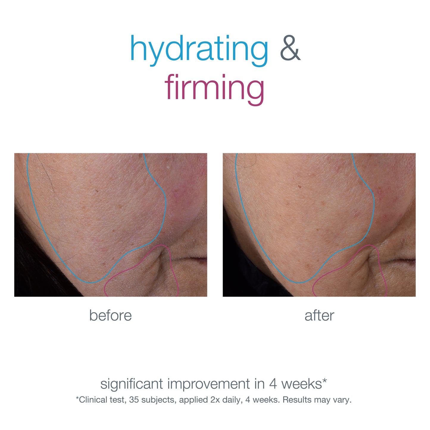 Smart Response Serum