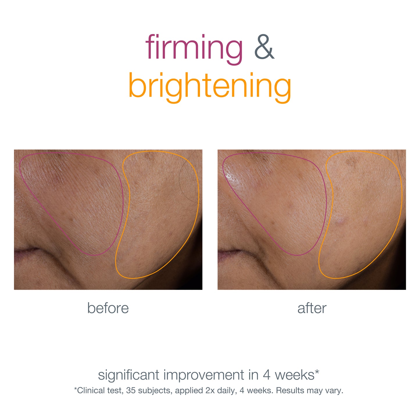 Smart Response Serum